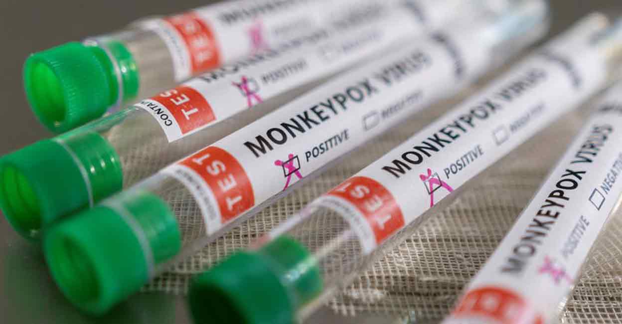 United Arab Emirates reports its first case of monkeypox!